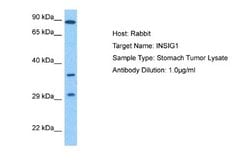 INSIG-1 Rabbit anti-Human, Polyclonal, Novus Biologicals 0.1 mL | Buy Online | Novus Biologicals | Fisher Scientific